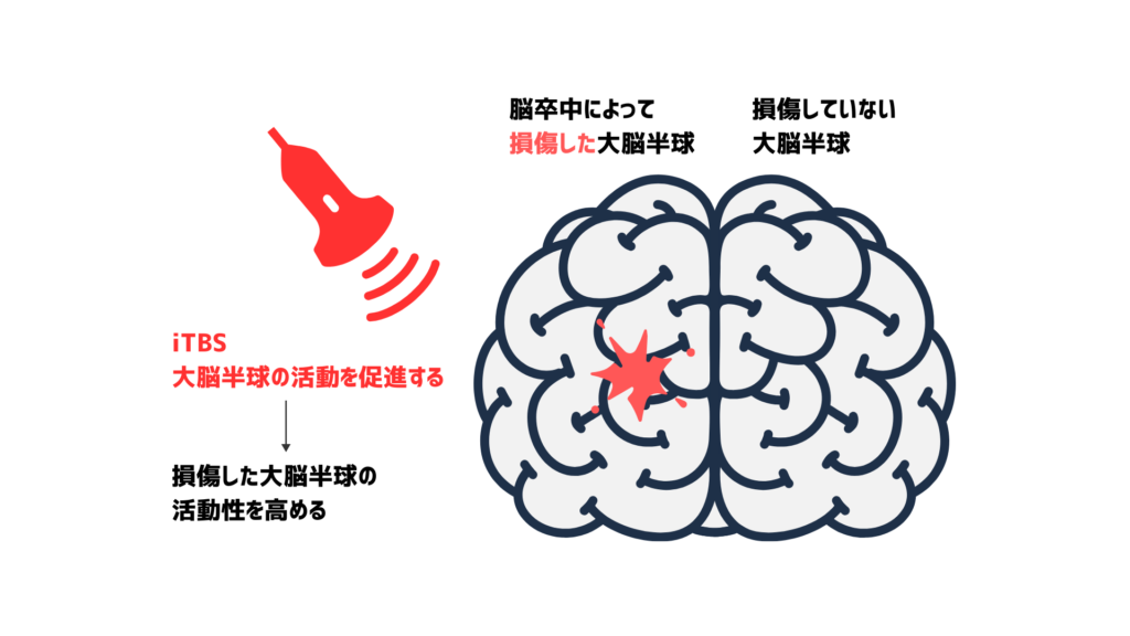 iTBSが損傷した大脳半球の活動を促進し、損傷した大脳半球の活動を高めている図