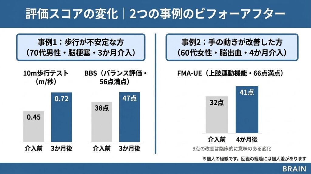 BRAINでリハビリに取り組まれた2事例の評価スコア変化グラフ。事例1（70代男性・脳梗塞・3か月介入）は10m歩行テストが0.45m/秒から0.72m/秒、BBS（バランス評価）が38点から47点に改善。事例2（60代女性・脳出血・4か月介入）はFMA-UE（上肢運動機能・66点満点）が32点から41点に改善し、9点の改善は臨床的に意味のある変化。