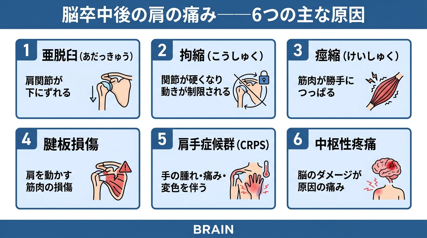 脳卒中後の肩の痛みの原因を図解。亜脱臼・拘縮・痙縮・腱板損傷・肩手症候群・中枢性疼痛の6つを表示