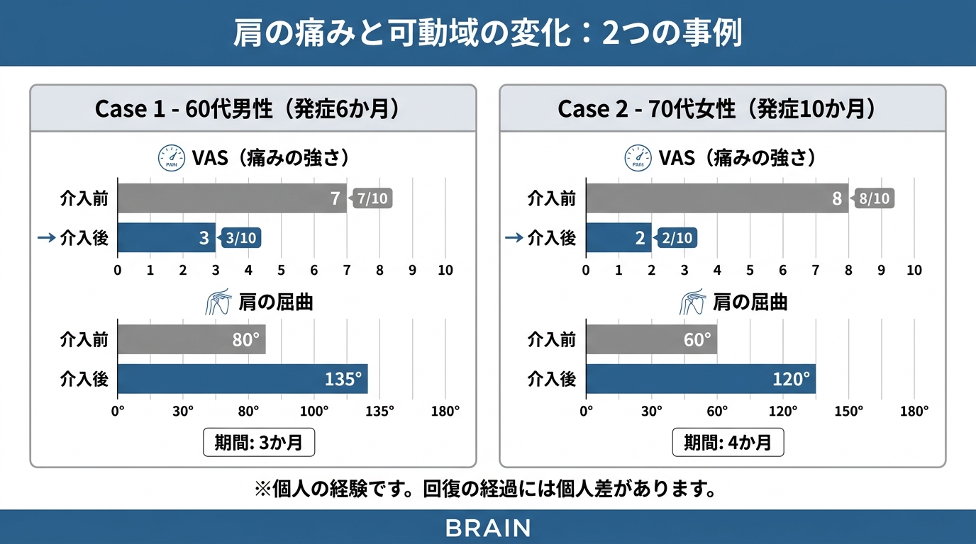 BRAINでリハビリに取り組まれた2つの事例のVASスコアと可動域の変化グラフ