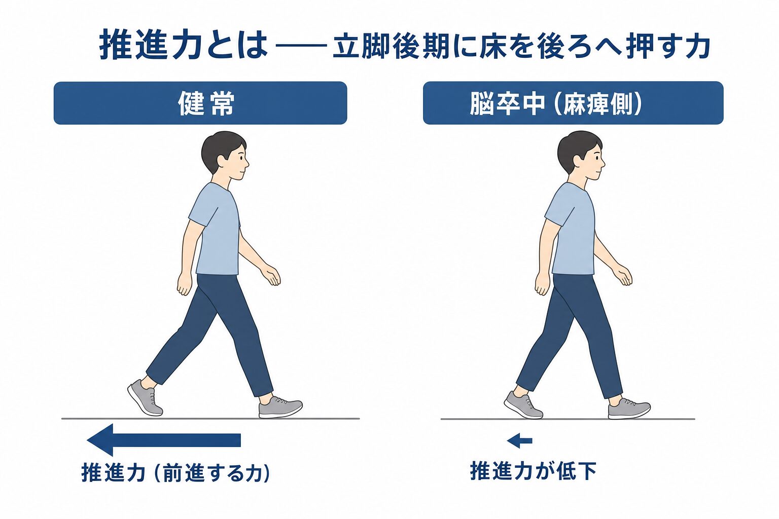 推進力の図解。立脚後期に床を後ろへ押す力が推進力（前進する力）で、健常では大きく、脳卒中の麻痺側では低下することを前後比較で示す。